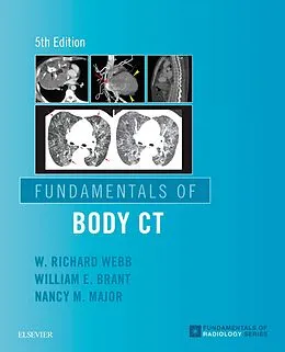 E-Book (epub) Fundamentals of Body CT E-Book von W Richard Webb MD, Facr Brant MD, Nancy M. Major MD