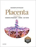 E-Book (epub) Diagnostic Pathology: Placenta von Amy Heerema-Mckenney, Edwina J. Popek, Monique E. de Paepe