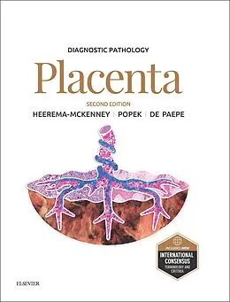 E-Book (epub) Diagnostic Pathology: Placenta von Amy Heerema-Mckenney, Edwina J. Popek, Monique E. de Paepe
