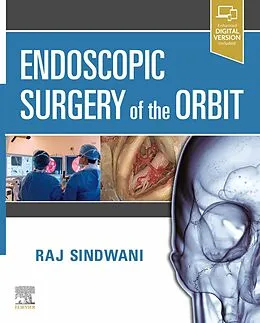 E-Book (epub) Endoscopic Surgery of the Orbit E-Book von Facs Sindwani MD