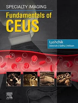 E-Book (epub) Specialty Imaging: Fundamentals of CEUS E-Book von Lyshchik MD