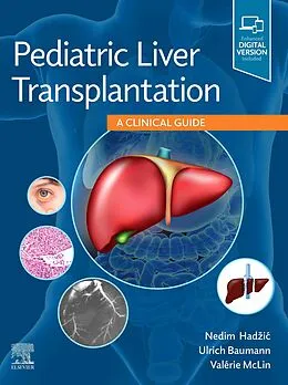 E-Book (epub) Pediatric Liver Transplantation von Nedim Hadzic, Ulrich Baumann, Valérie Mclin