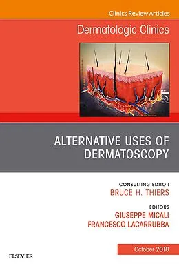 E-Book (epub) Alternative Uses of Dermatoscopy, An Issue of Dermatologic Clinics von Giuseppe Micali, Francesco Lacarrubba