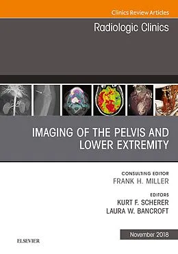 E-Book (epub) Imaging of the Pelvis and Lower Extremity, An Issue of Radiologic Clinics of North America von Laura Bancroft, Kurt Scherer