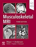 E-Book (epub) Musculoskeletal MRI E-Book von Nancy M. Major MD, Mark W. Anderson MD