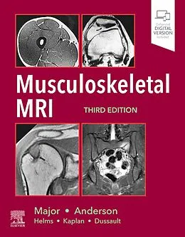 E-Book (epub) Musculoskeletal MRI E-Book von Nancy M. Major MD, Mark W. Anderson MD