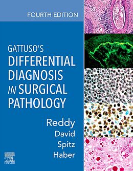 eBook (epub) Gattuso's Differential Diagnosis in Surgical Pathology de Mba Reddy MD, Mph David MD, Daniel J. Spitz MD