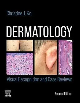 E-Book (epub) Dermatology: Visual Recognition and Case Reviews E-Book von Christine Ko MD
