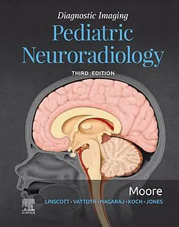 E-Book (epub) Diagnostic Imaging: Pediatric Neuroradiology E-Book von Kevin R. Moore