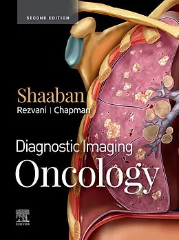 E-Book (epub) Diagnostic Imaging: Oncology von Akram M. Shaaban