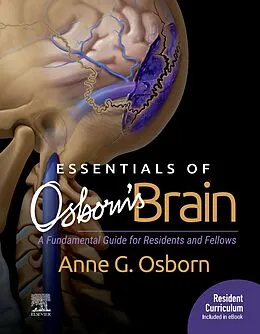 E-Book (epub) Essentials of Osborn's Brain E-Book von Anne G. Osborn