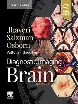 E-Book (epub) Diagnostic Imaging: Brain E-Book von Miral D. Jhaveri