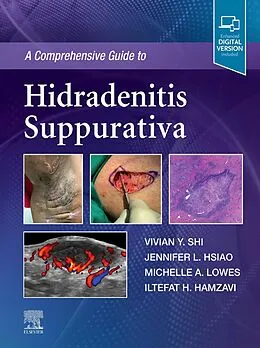 E-Book (epub) A Comprehensive Guide to Hidradenitis Suppurativa - EBook von Vivian Y. Shi MD, Jennifer L. Hsiao MD, Lowes MD