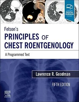 E-Book (epub) Felson's Principles of Chest Roentgenology E-Book von Faac Goodman MD