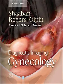 E-Book (epub) Diagnostic Imaging: Gynecology - E-Book von Akram M. Shaaban MBBCh, Douglas Rogers MD