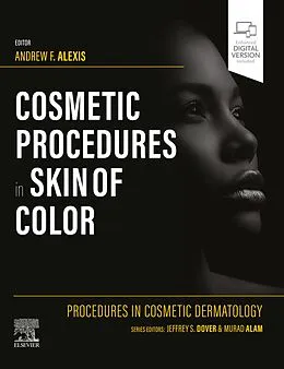 E-Book (epub) Procedures in Cosmetic Dermatology: Cosmetic Procedures in Skin of Color - E-Book von Andrew F. Alexis MD