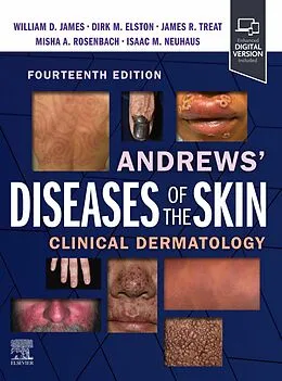 E-Book (epub) Andrews' Diseases of the Skin E-Book von William D. James, Dirk M. Elston, James R. Treat