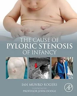 E-Book (epub) The Cause of Pyloric Stenosis of Infancy von Ian Munro Rogers