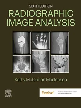 E-Book (epub) Radiographic Image Analysis - E-Book von Rt(R) Martensen MA