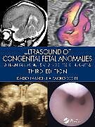 Livre Relié Ultrasound of Congenital Fetal Anomalies de Dario Paladini, Paolo Volpe