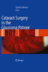 E-Book (pdf) Cataract Surgery in the Glaucoma Patient von Sandra M. Johnson