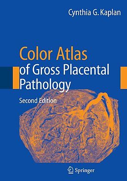 E-Book (pdf) Color Atlas of Gross Placental Pathology von Cynthia G. Kaplan
