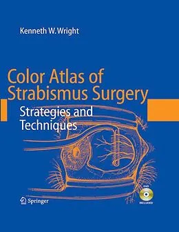 E-Book (pdf) Color Atlas of Strabismus Surgery von Kenneth W. Wright