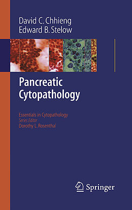 E-Book (pdf) Pancreatic Cytopathology von David C. Chhieng, Edward B. Stelow