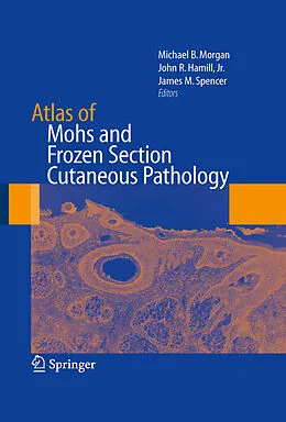 E-Book (pdf) Atlas of Mohs and Frozen Section Cutaneous Pathology von Michael B. Morgan, John R. Hamill, James M. Spencer