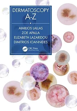 E-Book (pdf) Dermatoscopy A-Z von Aimilios Lallas, Zoe Apalla, Elizabeth Lazaridou
