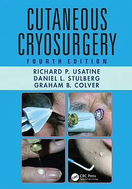 E-Book (epub) Cutaneous Cryosurgery von Richard P. Usatine, Daniel L. Stulberg, Graham B. Colver