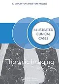 E-Book (epub) Thoracic Imaging von Sue Copley, David Hansell, Jeffrey Kanne