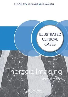 E-Book (epub) Thoracic Imaging von Sue Copley, David Hansell, Jeffrey Kanne