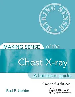 E-Book (epub) Making Sense of the Chest X-ray von Paul Jenkins
