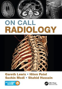 E-Book (epub) On Call Radiology von Gareth Lewis, Sachin Modi, Hiten Patel