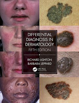 E-Book (epub) Differential Diagnosis in Dermatology von Richard Ashton, Barbara Leppard