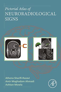 E-Book (epub) Pictorial Atlas of Neuroradiological Signs von Athena Sharifi-Razavi, Amir Moghadam Ahmadi, Ashkan Mowla