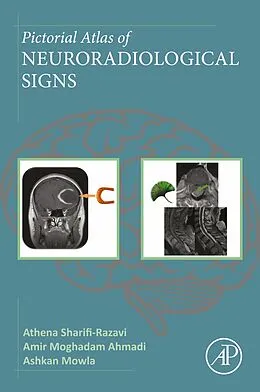 E-Book (epub) Pictorial Atlas of Neuroradiological Signs von Athena Sharifi-Razavi, Amir Moghadam Ahmadi, Ashkan Mowla