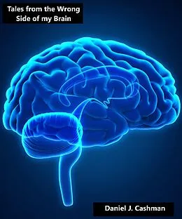 E-Book (epub) Tales from the Wrong Side of my Brain von Daniel Cashman