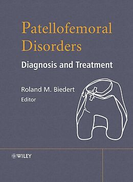 E-Book (pdf) Patellofemoral Disorders von 
