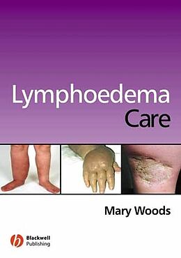 E-Book (pdf) Lymphoedema Care von Mary Elizabeth Woods