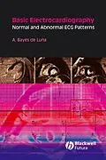 E-Book (pdf) Basic Electrocardiography von Antoni Bayés de Luna