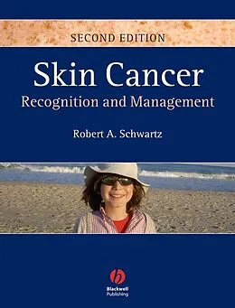 E-Book (pdf) Skin Cancer von Robert A. Schwartz