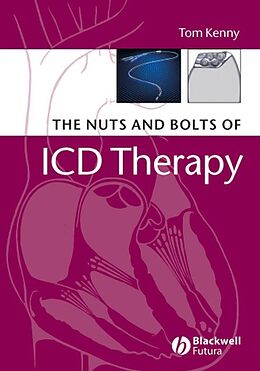 E-Book (pdf) The Nuts and Bolts of ICD Therapy von Tom Kenny