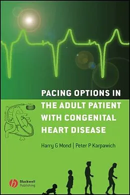 E-Book (pdf) Pacing Options in the Adult Patient with Congenital Heart Disease von Harry G. Mond, Peter P. Karpawich