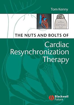 E-Book (pdf) The Nuts and Bolts of Cardiac Resynchronization Therapy von Tom Kenny