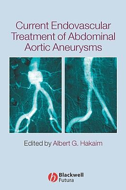 E-Book (pdf) Current Endovascular Treatment of Abdominal Aortic Aneurysms von 