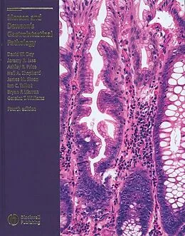 E-Book (pdf) Morson and Dawson's Gastrointestinal Pathology von David W. Day, Jeremy R. Jass, Ashley B. Price