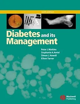 E-Book (pdf) Diabetes and Its Management von Peter J. Watkins, Stephanie A. Amiel, Simon L. Howell