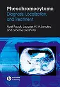 E-Book (pdf) Pheochromocytoma von Karel Pacak, Graeme Eisenhofer, Jacques Lenders